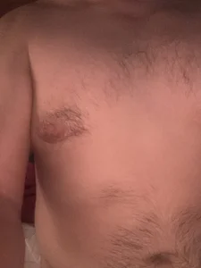 UncoiledPuseyism Public Pic