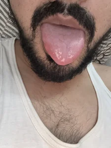 hottboynill Hoty 사진