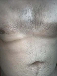 laharl69 Hunk Immagine 