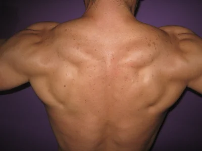 Anthony_Hard Public Hình 5