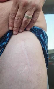 panda_06200 my scars Billede 2