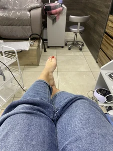 Pedicure before and after de Wet_Maria  Imagens