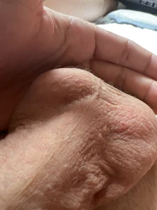 Balls de Nicfick  photos