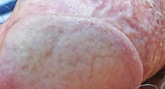 jhonschen's Idrospezione Sex Photo 8