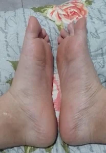 SUDOR20FEET Pies 사진 3