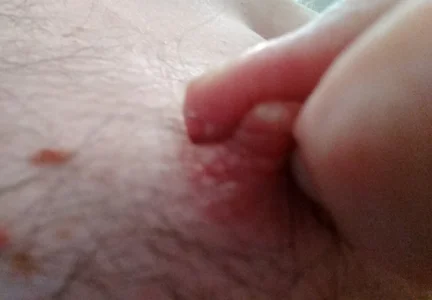 Nippelbilder od 6livekamera@xh  3 snímek