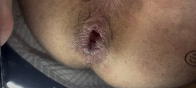 Explosiongape Public Pic