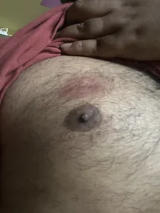 Vicky20256 Love bites on nipples 사진