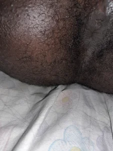 loveyxxxxxxxxのAssの枚の写真