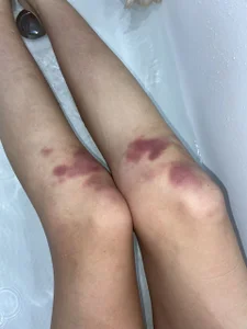 Public de Sora4U  Imagens