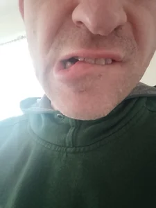 openlegsforyou Free Immagine 