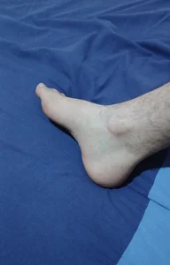 Mis pies de MorbidMan69 Foto 2