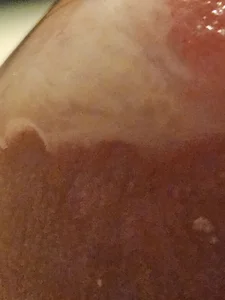 Gris-shadow Kuckt Bilde