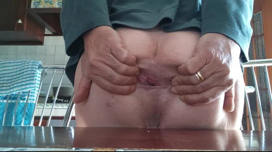 jhonschen's Grosso aglio nel prepuzio Sex Photo 8