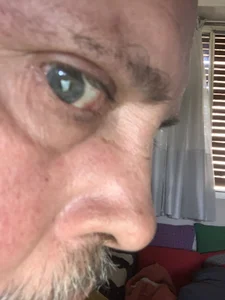 Toskito $$ Billede 3