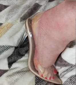 dirtyBonnie Public Bilde 2