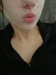DaynaMacha Mask procedures🤭 Pic 5
