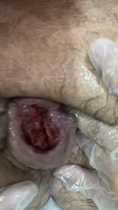 FistNowAD Private Pic 8