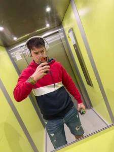 vitiligoDaiv Public Fotka