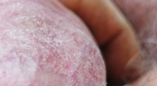 jhonschen's Idrospezione Sex Photo 6