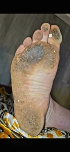 solotoes Feet😉 Billede 2