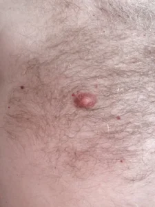 schlueppee64 Public صورة واحدة|schlueppee64 Public صورتان|schlueppee64 Public  صور|schlueppee64 Public  صورة