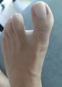 dowyking-93 Public Foto