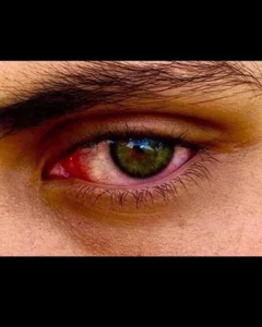 canochvz Public 사진