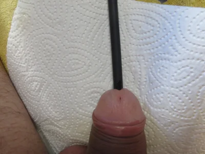 licci7895 Dilator صورة واحدة|licci7895 Dilator صورتان|licci7895 Dilator  8 صور|licci7895 Dilator  8 صورة