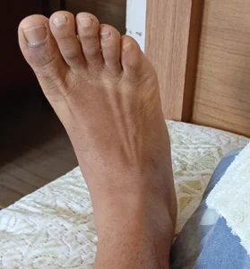 JohnVasconcelos Public Billede 2