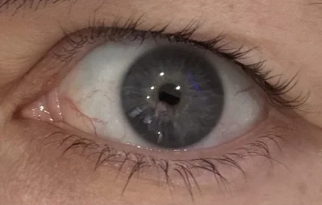 Betty2u Public Billede 3