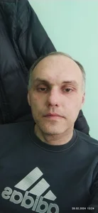 Public de Pineapple04  Imagens