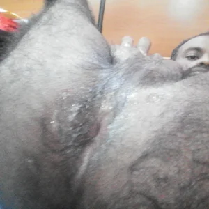 FlatBlackboard Ass Bilde