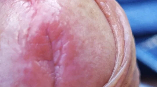 jhonschen's Idrospezione Sex Photo 7
