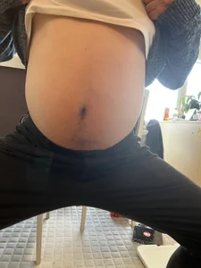 Zdjęcia Arista_09 昔の私🤣: 
