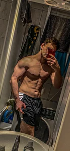 vitiligoDaiv My body😈 Fotka 5