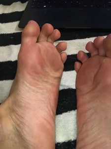 Only feet od zikaadorskss  snímek