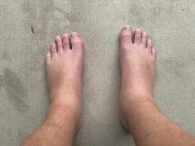MikeHonchosFeet My Feet Bilde
