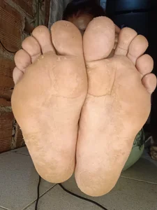 Peeling feet close-up🔥 de roxxy_white  3 Imagens