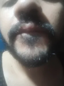Fotos