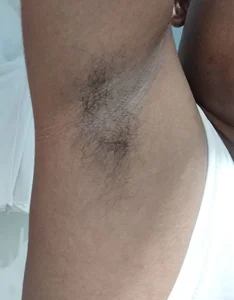 chennai24callboy sexy arm pit Immagine 