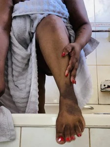 ebonylimper Public Pic 3