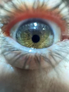 ALTOVOLTAGEO1: Public ( 5 фото)