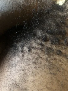 Hairy de MzansiMonster  photos