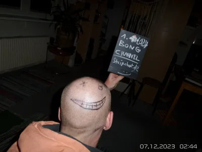 BongChannel Invite  5. fénykép