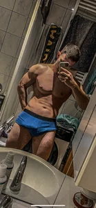 vitiligoDaiv My body😈 Fotka 4