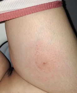 Mina-pusyのPublicの 2枚の写真