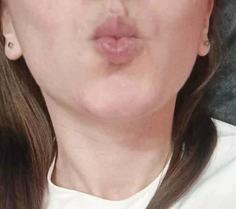 MaxWellas6 Public Billede 6