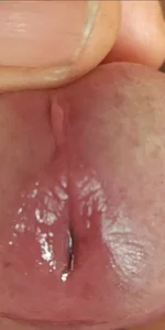 jhonschen's Che bel primo piano..... Sex Photo 3