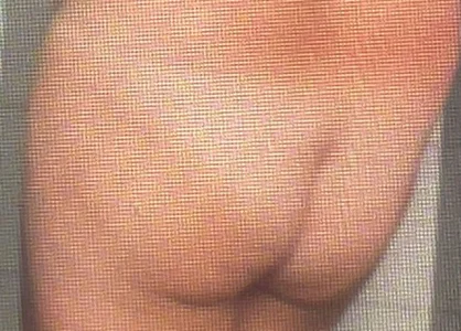 Cul